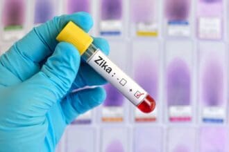 ¿Qué es y cómo se transmite el Zika?